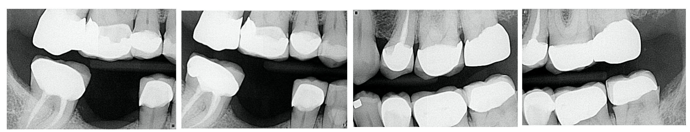 digital x-rays photo