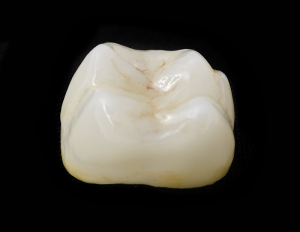 dental crowns photo